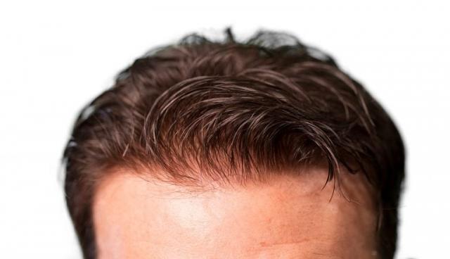 Tips to Pick the Right Balding Piece for Men